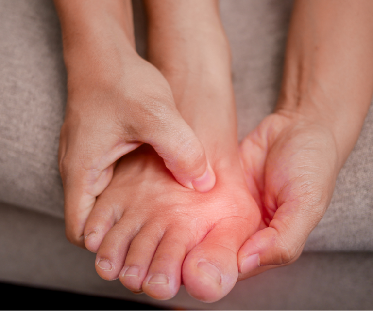 Person holding bunion on their foot at base of big toe