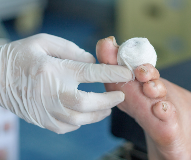 doctor bandaging a wound
